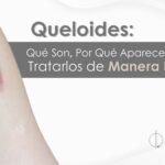 Queloides: Entendiendo y Tratando Cicatrices Anómalas