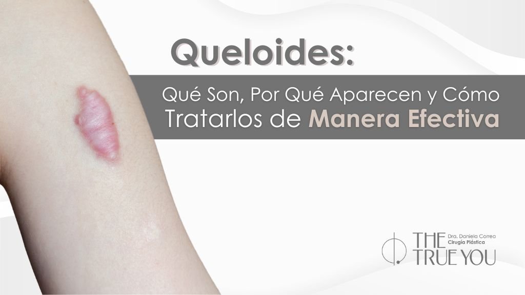 Queloides: Entendiendo y Tratando Cicatrices Anómalas