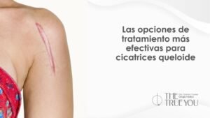 Cicatrices queloide tratamiento - Dra. Daniela Correa - cirujana plástica en Medellín, Colombia
