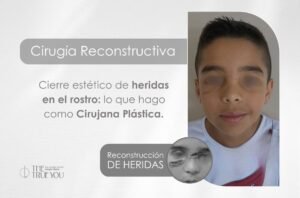 Como curar una herida en la cara sin dejar cicatriz - Dra. Daniela Correa - cirujana plástica en Medellín