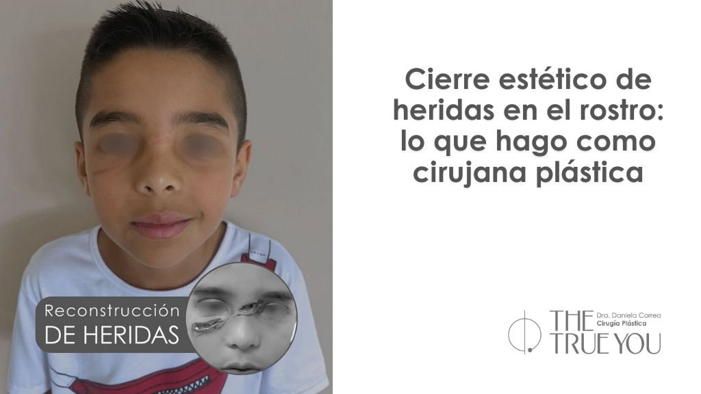 Como curar una herida en la cara sin dejar cicatriz - Dra. Daniela Correa - cirujana plástica en Medellín