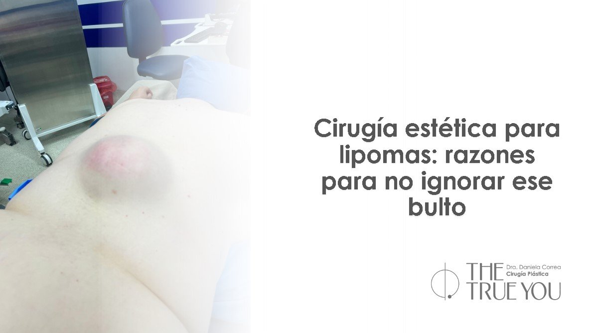 Eliminación de lipoma- Dra. Daniela Correa- Cirujana plástica