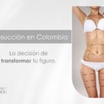 Liposucción en Colombia-Dra. Daniela Correa