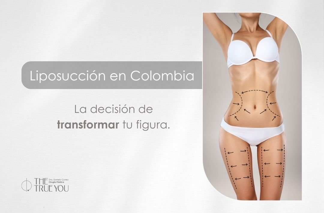 Liposucción en Colombia-Dra. Daniela Correa