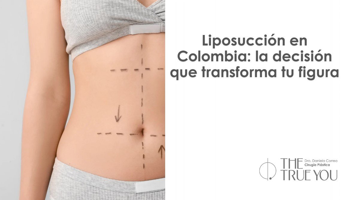 Liposucción en Colombia-Dra. Daniela Correa