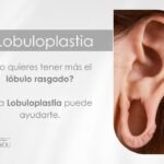 Lobuloplastia en Medellín por la Dra. Daniela Correa Cirujana plástica