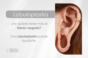 Lobuloplastia en Medellín por la Dra. Daniela Correa Cirujana plástica