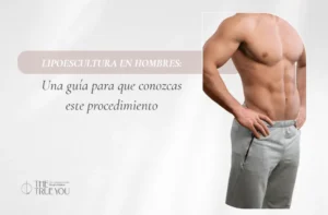 Lipoescultura en hombres- Dra. Daniela Correa