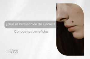 ¿Qué es la resección de lunares?-Dra. Daniela Correa