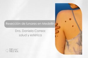 Resección de lunares en Medellín- Dra. Daniela Correa