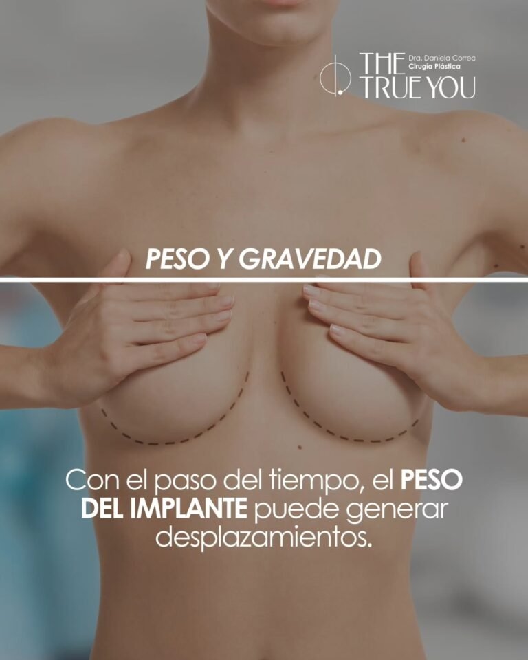 Cambio de implantes-Dra. Daniela Correa