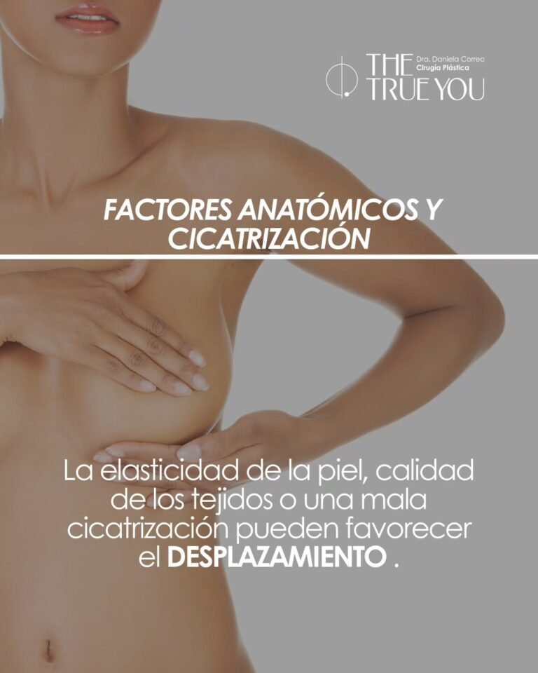Cambio de implantes-Dra. Daniela Correa