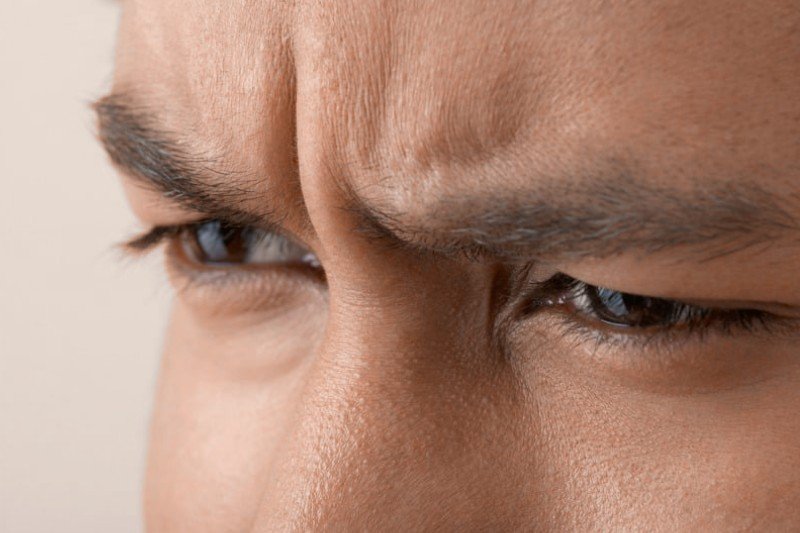 Botox en hombres para entrecejo - Cirujana plástica en Medellín Daniela Correa