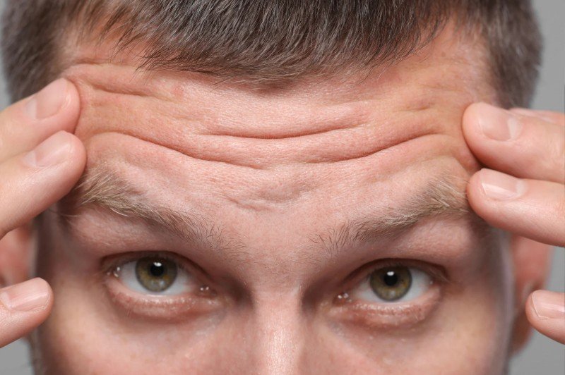 Botox en hombres para frente - Cirujana plástica en Medellín Daniela Correa