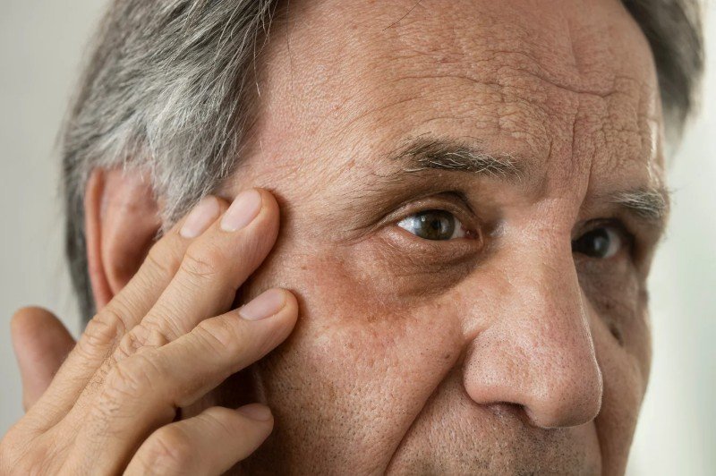 Botox para patas de gallo en hombres - Cirujana plástica en Medellín Daniela Correa