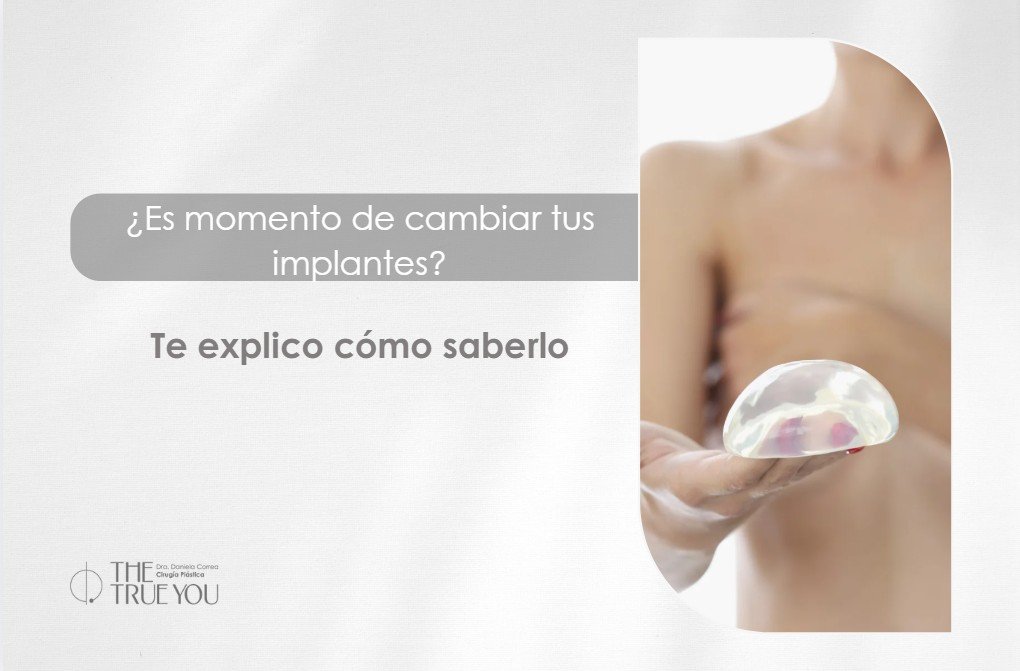 Cambio de implantes-Dra. Daniela Correa