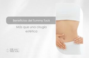 Beneficios del Tummy Tuck-Dra. Daniela Correa