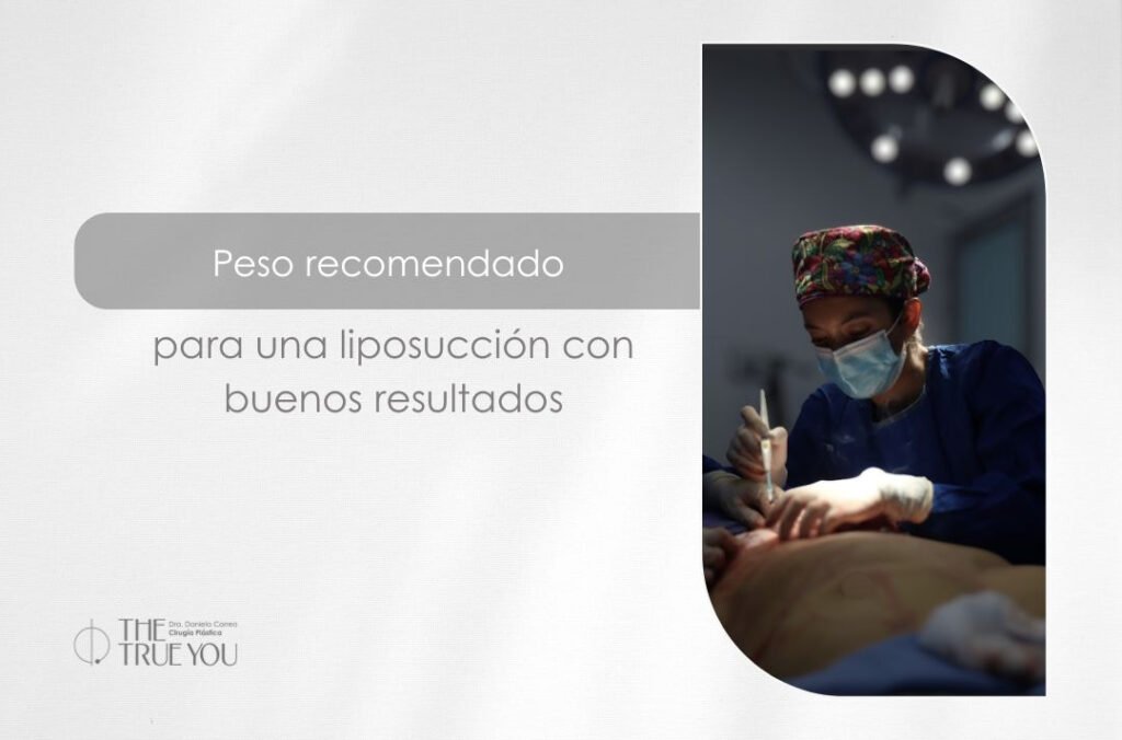 Hasta qué peso se puede hacer una liposucción - Dra. Daniela Correa
