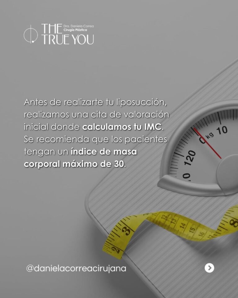 Lipo en gorditas en Medellín - Dra. Daniela Correa, Dr. Martín Quirós 2
