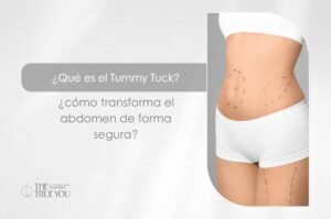 Qué es el Tummy Tuck-Dra. Daniela Correa