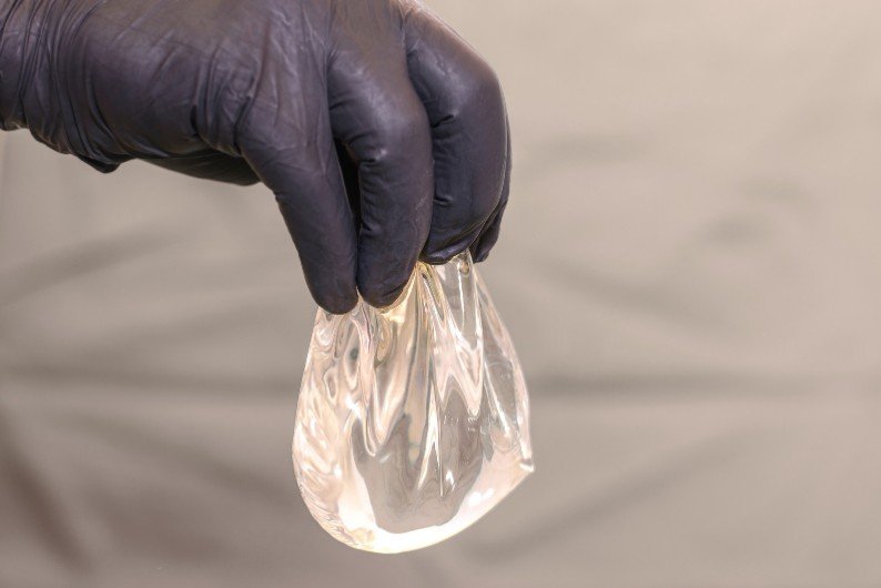 Tamaño de implantes de senos - implantes anatómicos - Dra. Daniela Correa