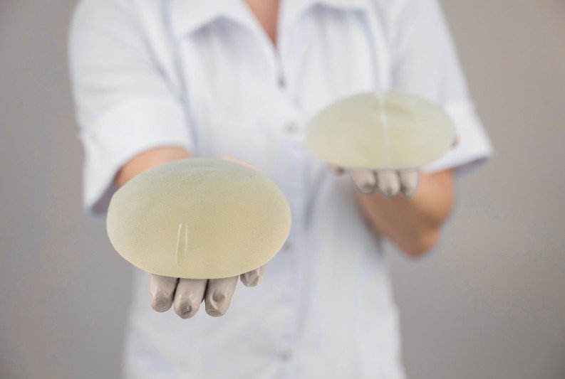 Tamaño de implantes de senos - implantes redondos - Dra. Daniela Correa