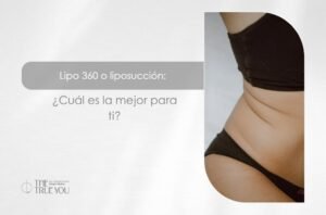 Lipo 360 o liposucción-Dra. Daniela Correa