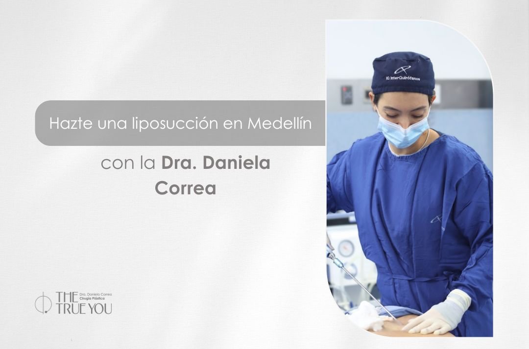 Liposucción en Medellín con la cirujana plástica de Colombia Daniela Correa