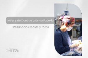 Mastopexia antes y después - Cirujana plástica en Medellín Daniela Correa