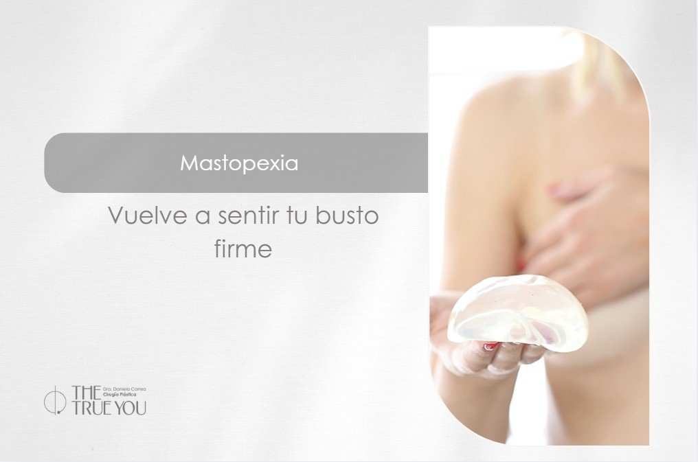 Mastopexia con implantes-Dra. Daniela Correa