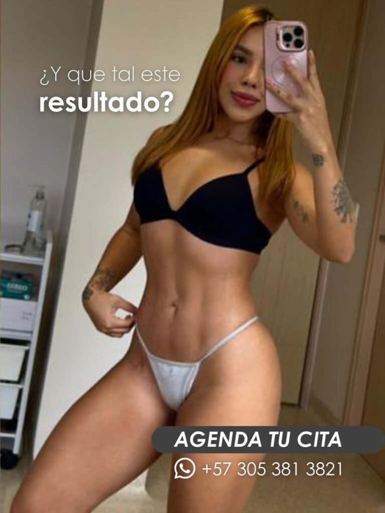 Aumento de glúteos en Medellín con la doctora Daniela Correa Cirujana plástica en Colombia