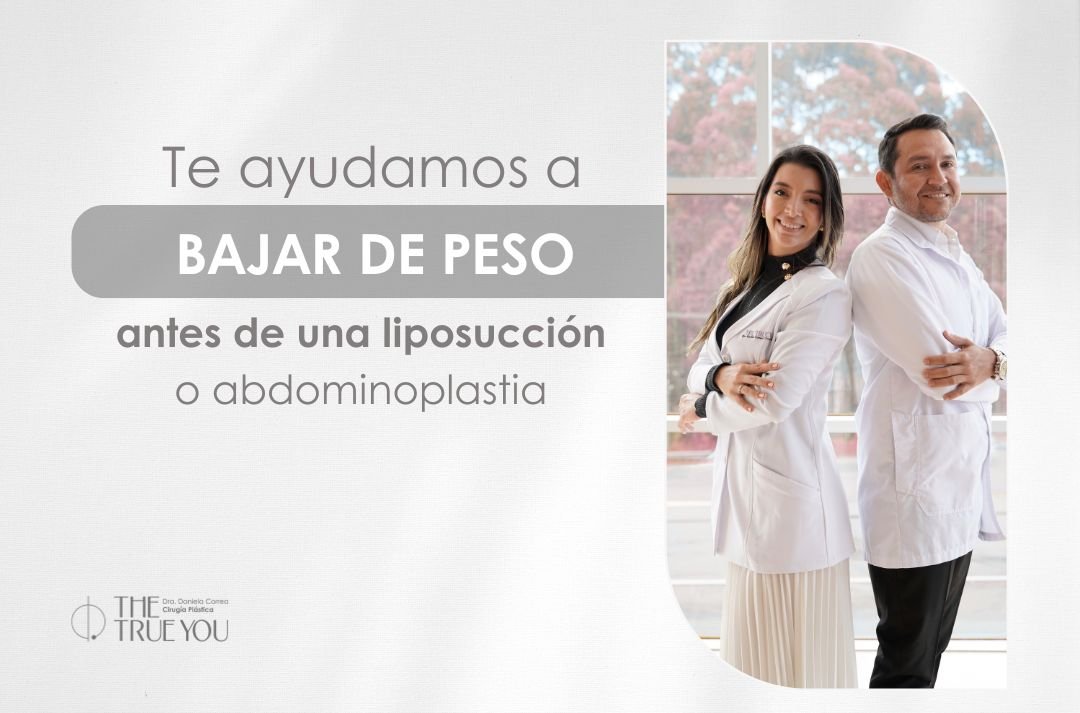 Cómo bajar de peso de forma segura antes de una liposucción o abdominoplastia - Dra Daniela Correa - Medellín, Colombia 1