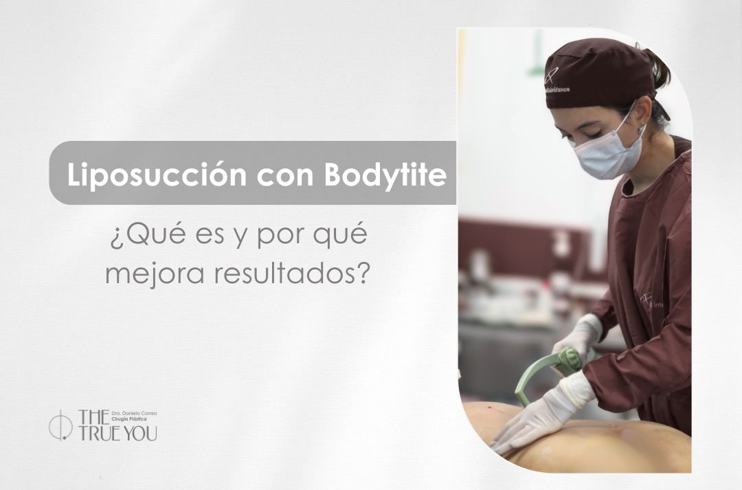 Liposucción con Bodytite en Medellín, Colombia con la cirujana plástica Daniela Corea