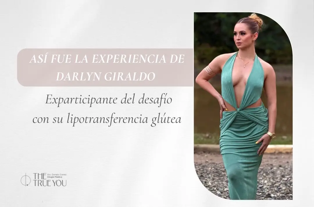 Así fue la experiencia de Darlyn Giraldo Exparticipante del desafío con su lipotransferencia glútea Dra Daniela Correa