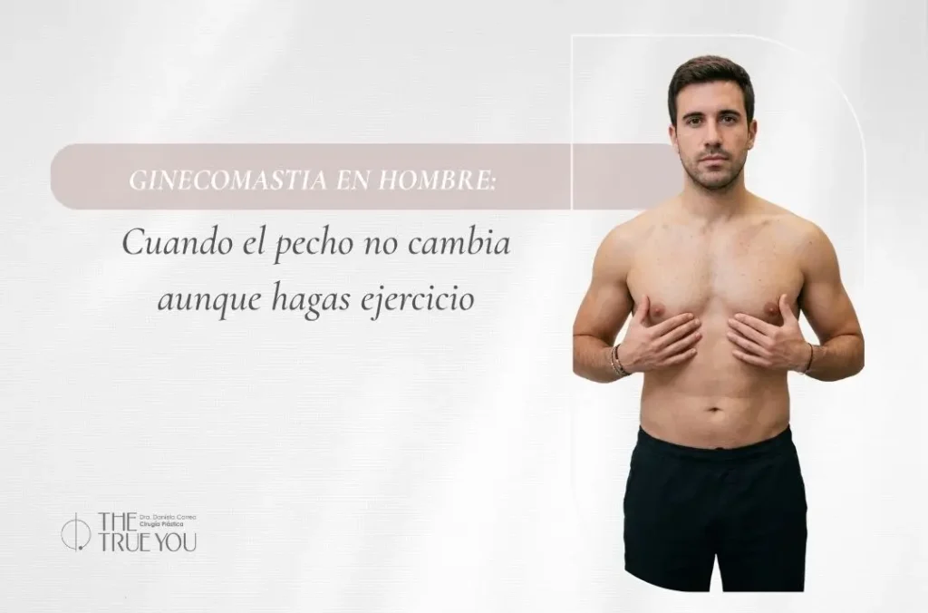 Ginecomastia en hombre cuando el pecho no cambia aunque hagas ejercicio - Dra Daniela Correa