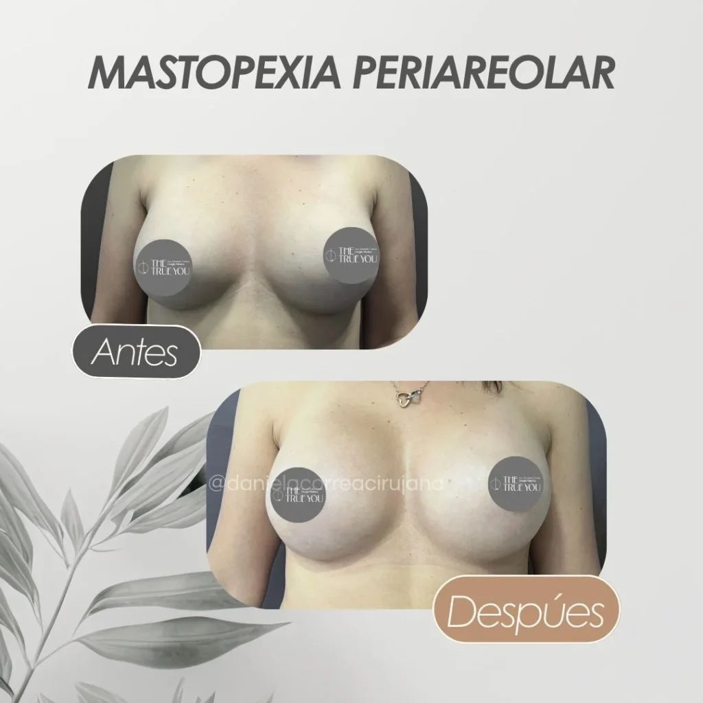 Mejor cirujana de mamas en Colombia-Dra. Daniela Correa