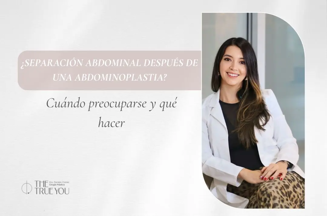 Se pueden soltar los músculos después de una abdominoplastia - Dra Daniela Correa
