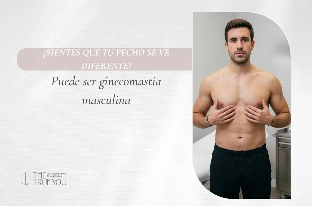 Sientes que tu pecho se ve diferente Puede ser ginecomastia masculina - Dra Daniela Correa
