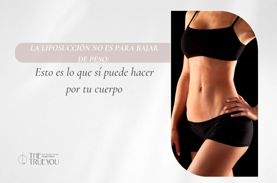 La liposucción no es para bajar de peso Esto es lo que sí puede hacer por tu cuerpo - Dra Daniela Correa
