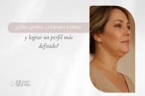 Cómo quitar la papada rápido y lograr un perfil más definido - Dra Daniela Correa