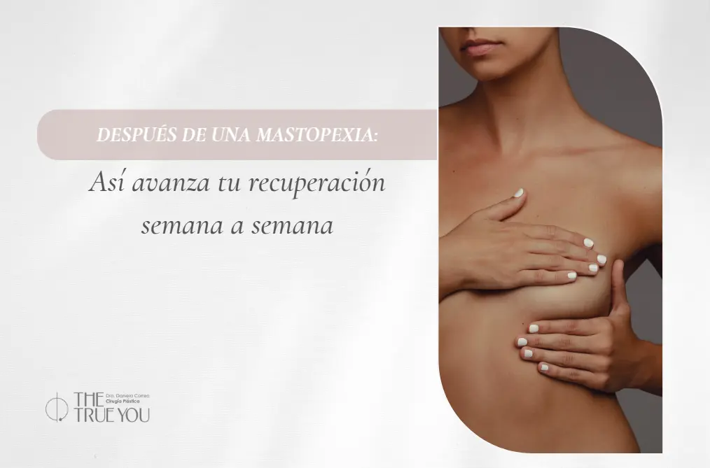 Recuperación de una mastopexia- Dra. Daniela Correa- cirujana plástica en Medellín