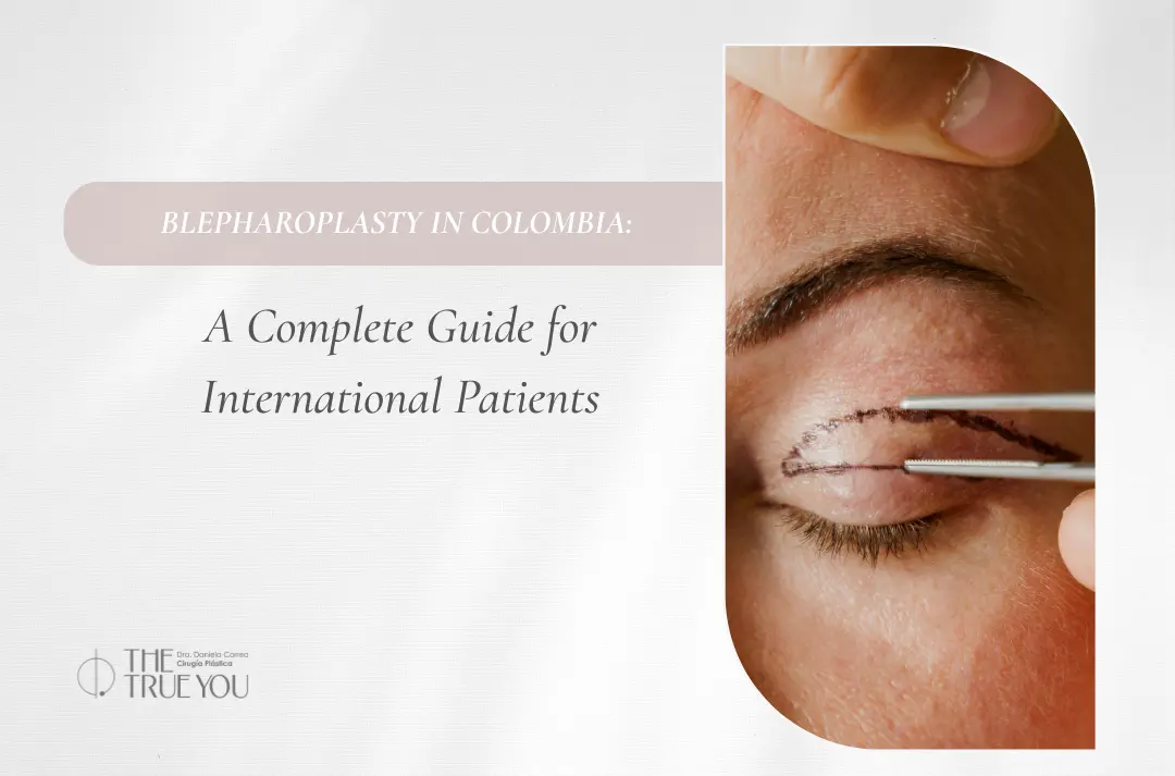 Blepharoplasty in Colombia - Dra. Daniela Correa - Medellín, Colombia