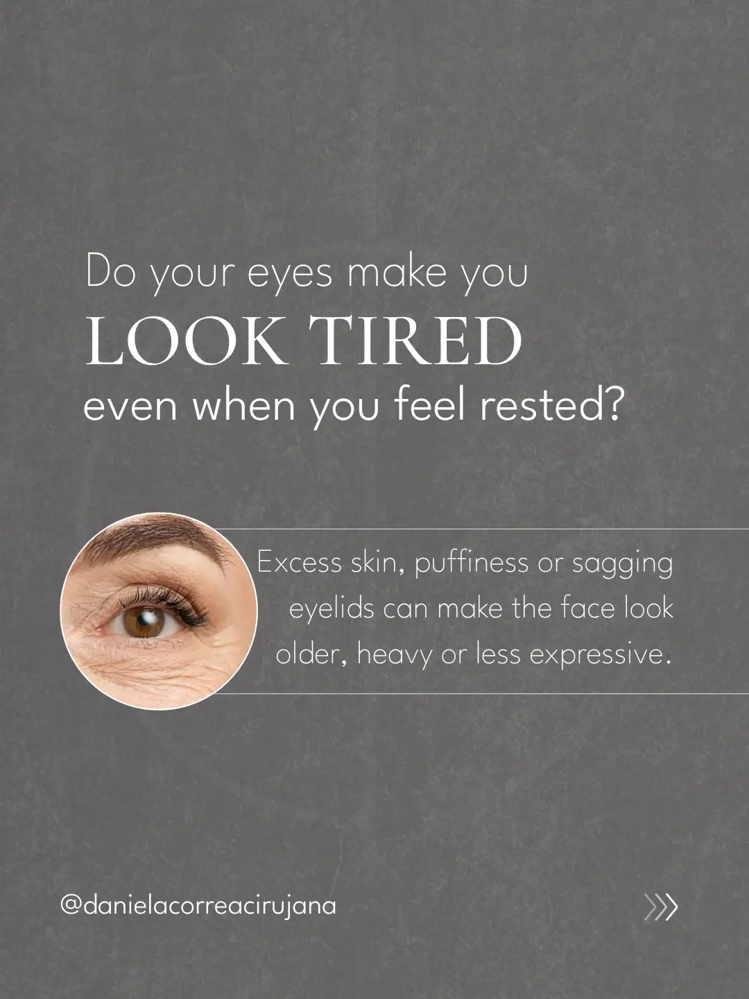 Eyelid Surgery in Medellín