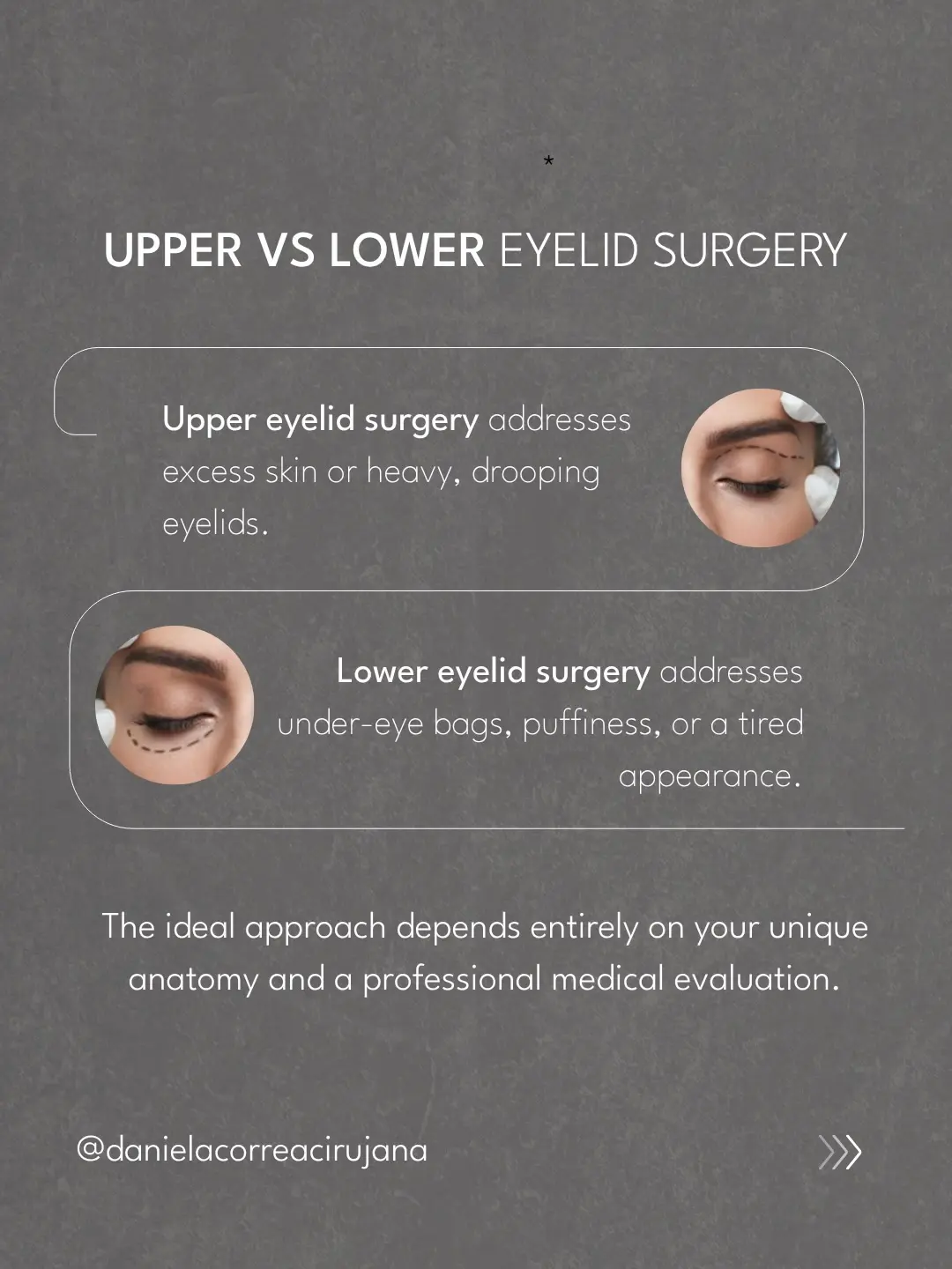 Blepharoplasty in Medellín - Dra. Daniela Correa