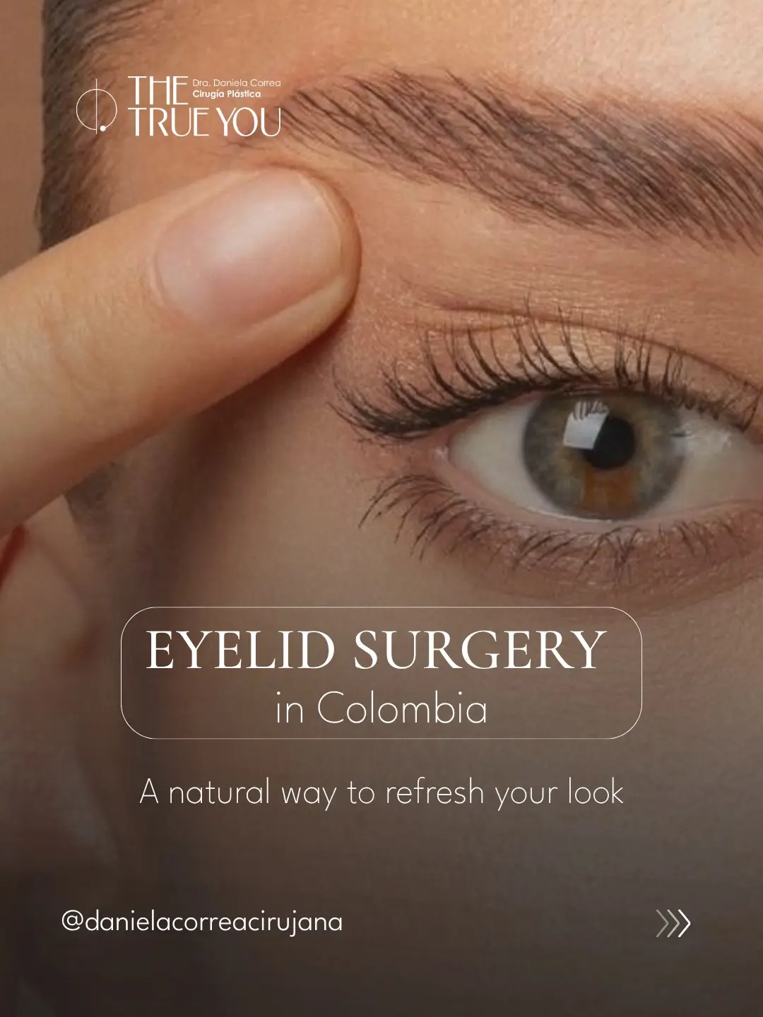 Eyelid Surgery in Colombia