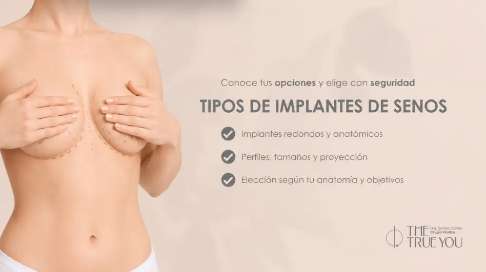 Tipos de implantes de senos- Dra. Daniela Correa