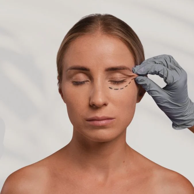 Más allá de los años: ¿cómo saber cuál es la edad ideal para una cirugía plástica? - Blefaroplastia-en-Medellin-Cirugia-de-Parpados-Dra.-Daniela-Correa
