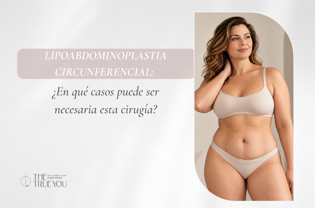 Lipoabdominoplastia circunferencial En qué casos puede ser necesaria esta cirugía - Dra Daniela Correa