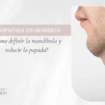 Lipopapada en hombres-Dra. Daniela Correa- Cirujana Plástica