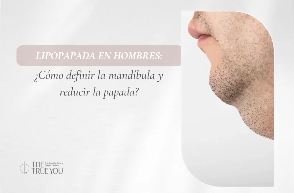 Lipopapada en hombres-Dra. Daniela Correa- Cirujana Plástica